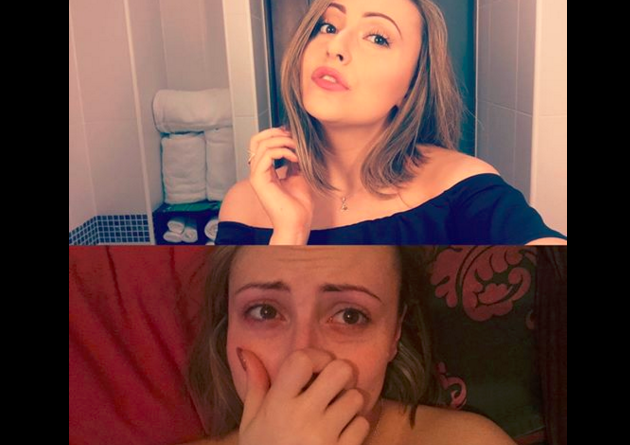 Hrabra djevojka razbija stigmu mentalnih bolesti: ‘Ovo sam ja prije i poslije napadaja panike’